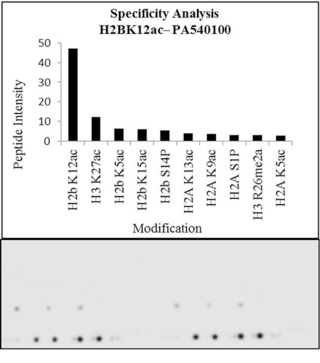 H2BK12ac Antibody