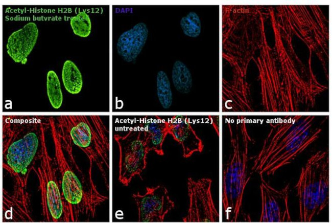 H2BK12ac Antibody in Immunocytochemistry (ICC/IF)