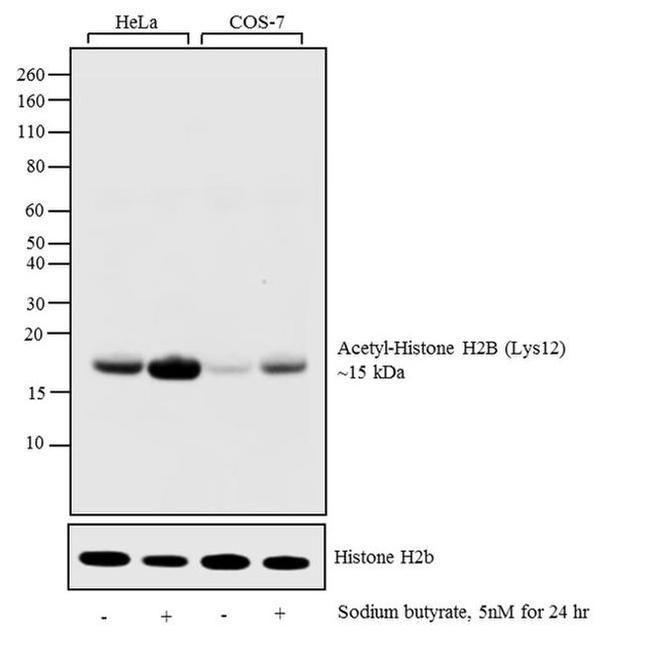 H2BK12ac Antibody in Western Blot (WB)