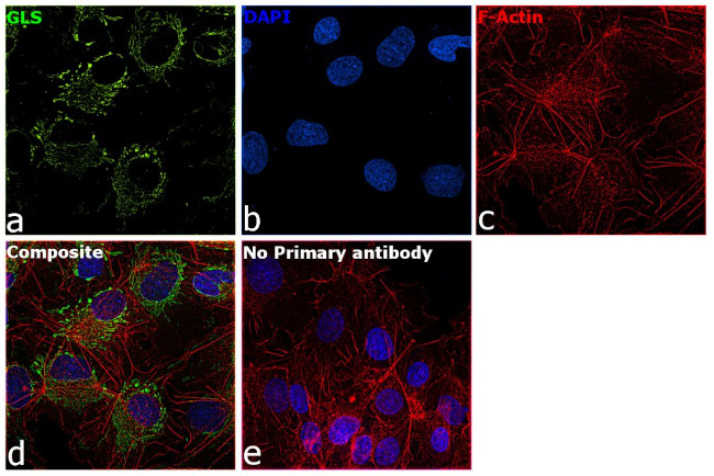 Glutaminase C (GAC) Antibody in Immunocytochemistry (ICC/IF)