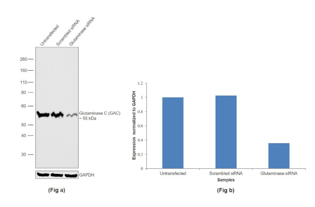 Glutaminase C (GAC) Antibody