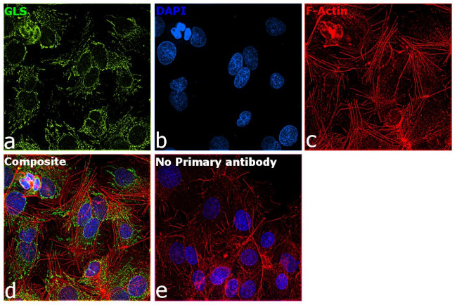 Glutaminase C (GAC) Antibody in Immunocytochemistry (ICC/IF)