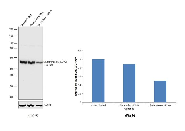 Glutaminase C (GAC) Antibody in Western Blot (WB)