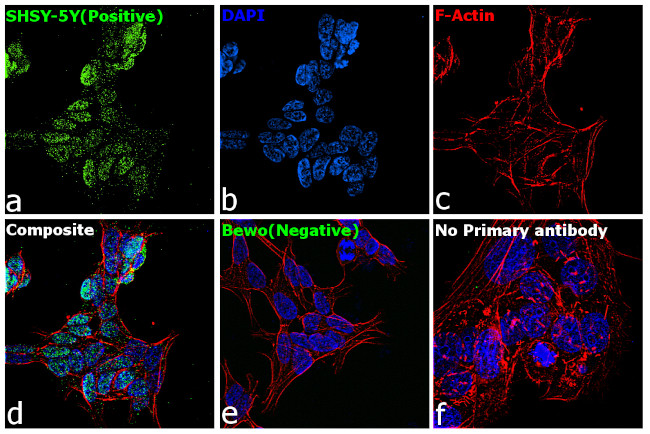 SOX11 Antibody