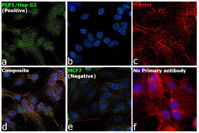 PLP1 Antibody