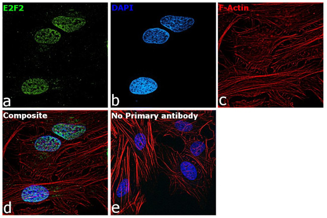 E2F2 Antibody in Immunocytochemistry (ICC/IF)