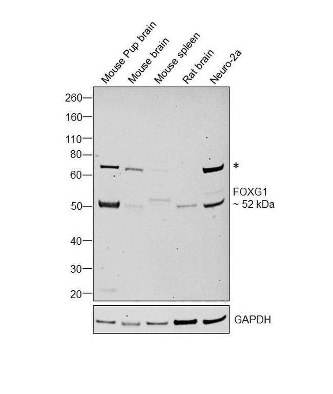FOXG1 Antibody in Western Blot (WB)