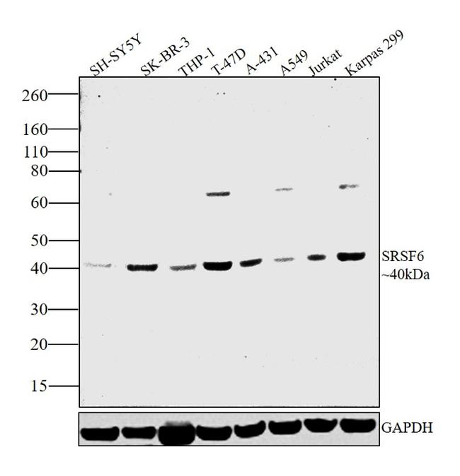 SRSF6 Antibody in Western Blot (WB)