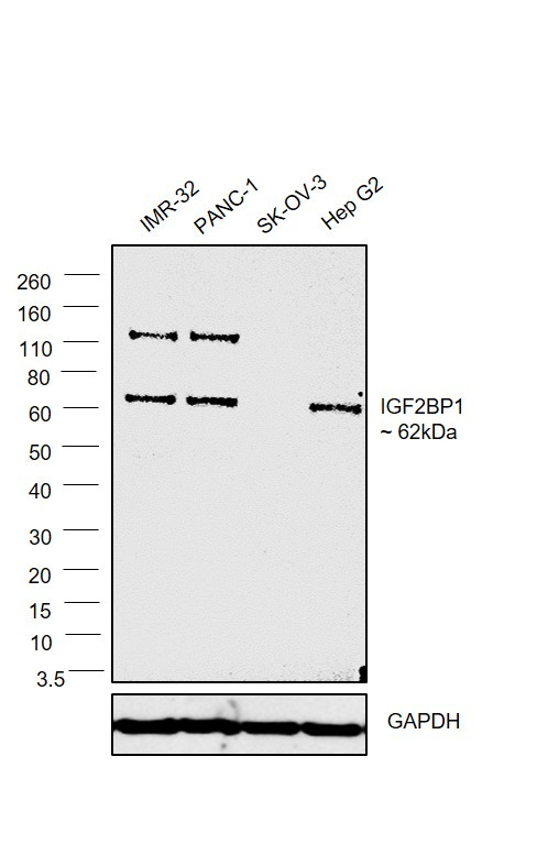 IGF2BP1 Antibody