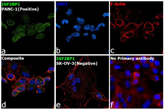 IGF2BP1 Antibody in Immunocytochemistry (ICC/IF)