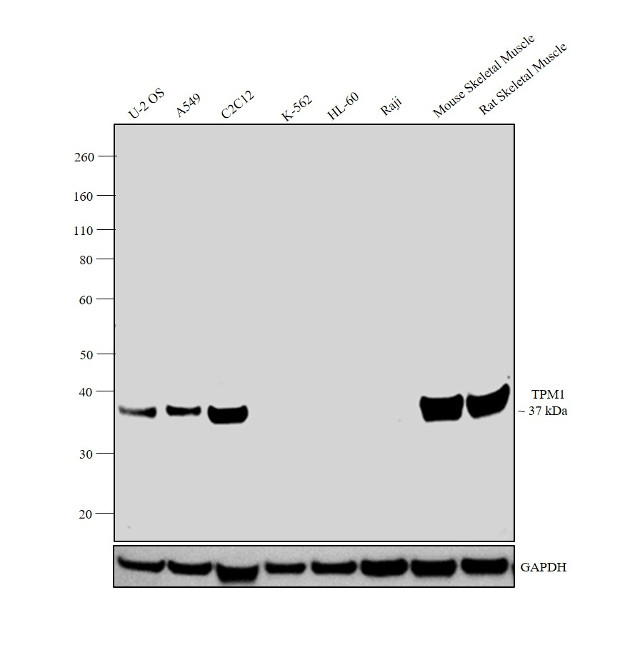 TPM1 Antibody