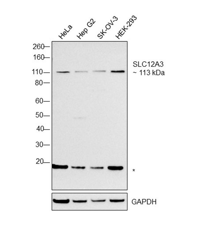 SLC12A3 Antibody in Western Blot (WB)