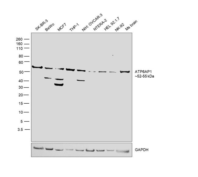 ATP6AP1 Antibody in Western Blot (WB)