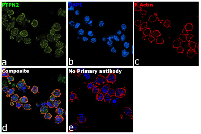 PTPN2 Antibody in Immunocytochemistry (ICC/IF)