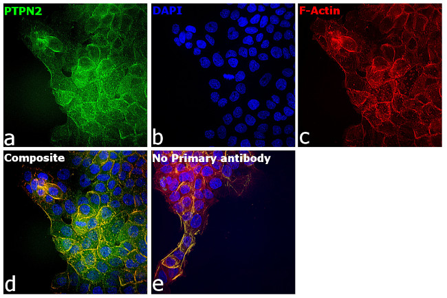 PTPN2 Antibody in Immunocytochemistry (ICC/IF)