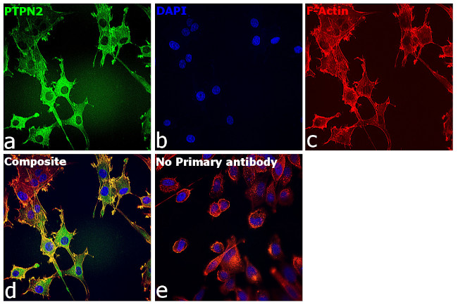 PTPN2 Antibody in Immunocytochemistry (ICC/IF)