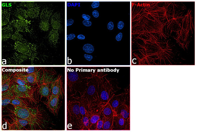 Glutaminase Antibody in Immunocytochemistry (ICC/IF)