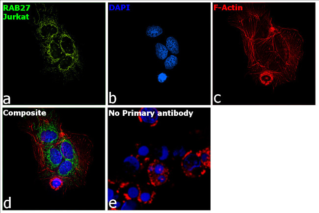 RAB27A Antibody in Immunocytochemistry (ICC/IF)