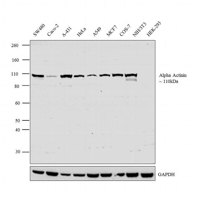 alpha Actinin 1 Antibody in Western Blot (WB)