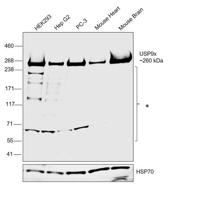 USP9X Antibody in Western Blot (WB)