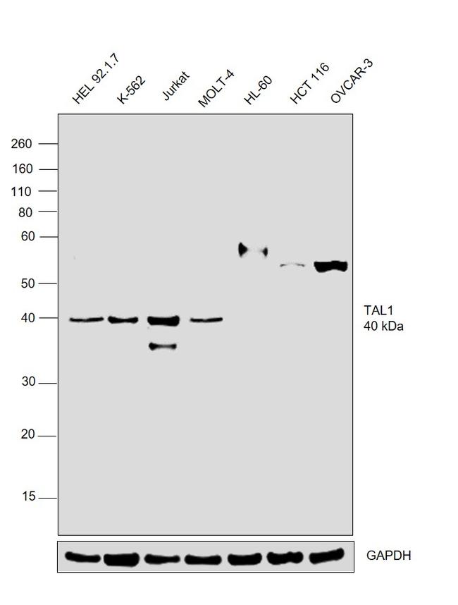 TAL1 Antibody in Western Blot (WB)