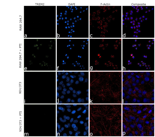 TREM2 Antibody