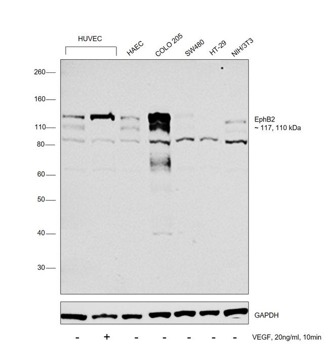 EphB2 Antibody in Western Blot (WB)