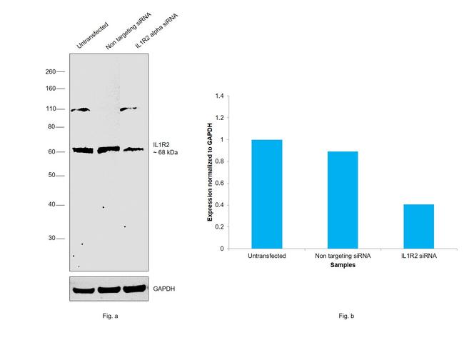 IL1R2 Antibody in Western Blot (WB)