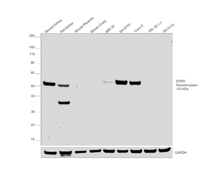 DOPA Decarboxylase Antibody