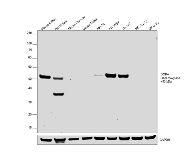 DOPA Decarboxylase Antibody in Western Blot (WB)