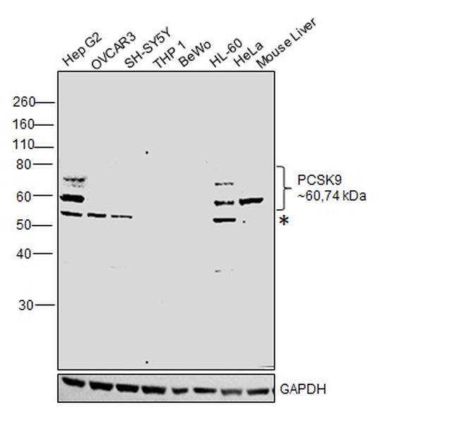 PCSK9 Antibody in Western Blot (WB)