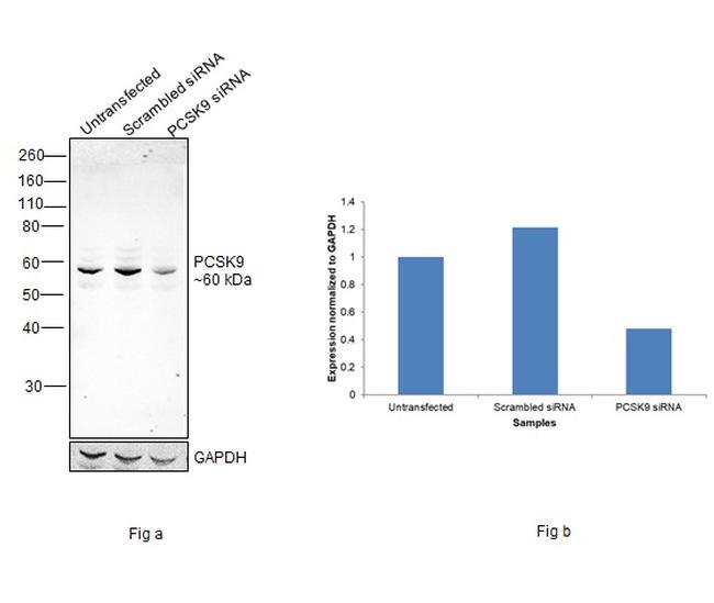 PCSK9 Antibody in Western Blot (WB)