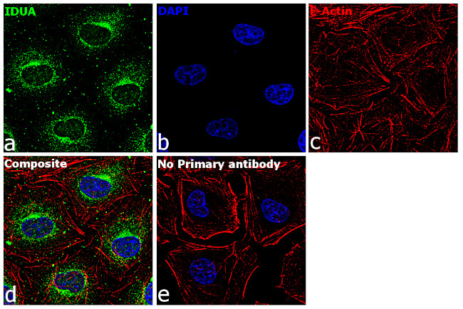 IDUA Antibody in Immunocytochemistry (ICC/IF)