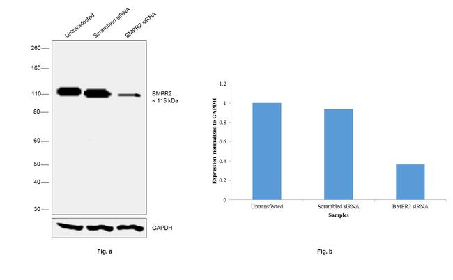 BMPR2 Antibody in Western Blot (WB)