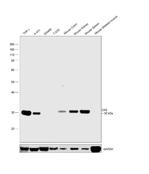 Carbonic Anhydrase II Antibody