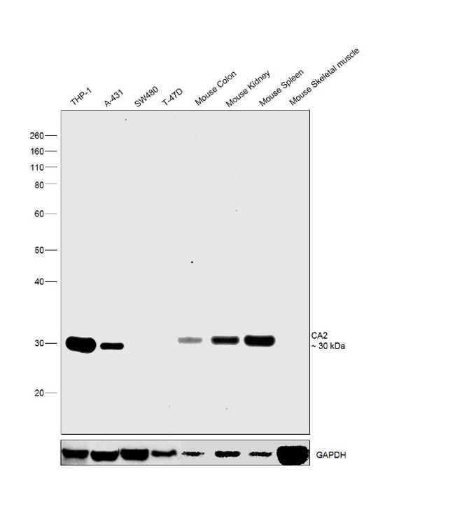 Carbonic Anhydrase II Antibody in Western Blot (WB)