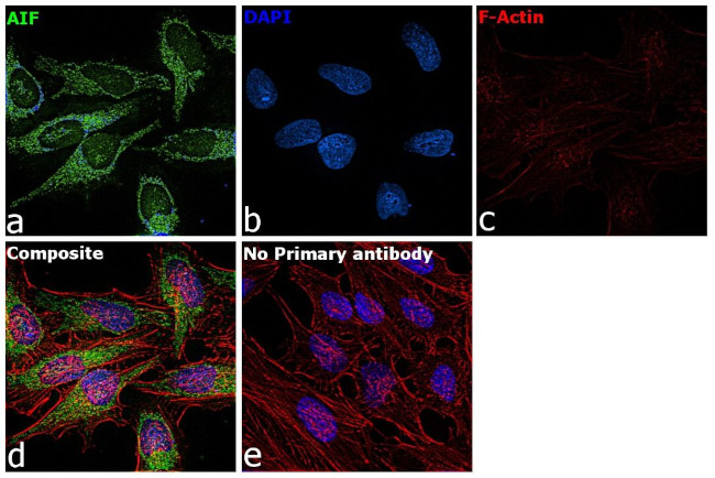 AIF Antibody in Immunocytochemistry (ICC/IF)