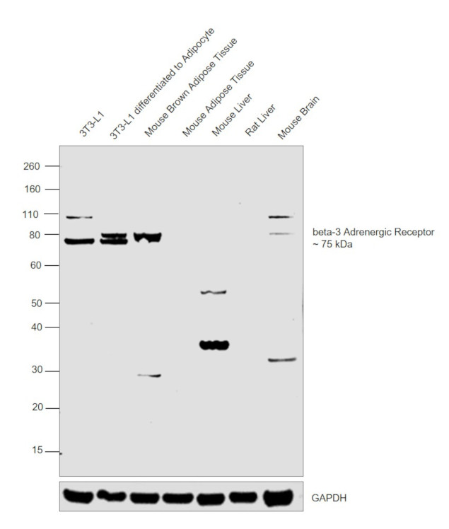 beta-3 Adrenergic Receptor Antibody