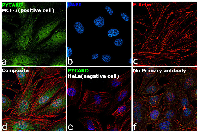 PYCARD Antibody in Immunocytochemistry (ICC/IF)