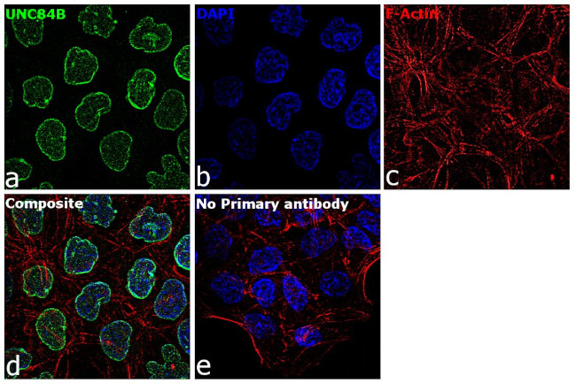 UNC84B Antibody in Immunocytochemistry (ICC/IF)