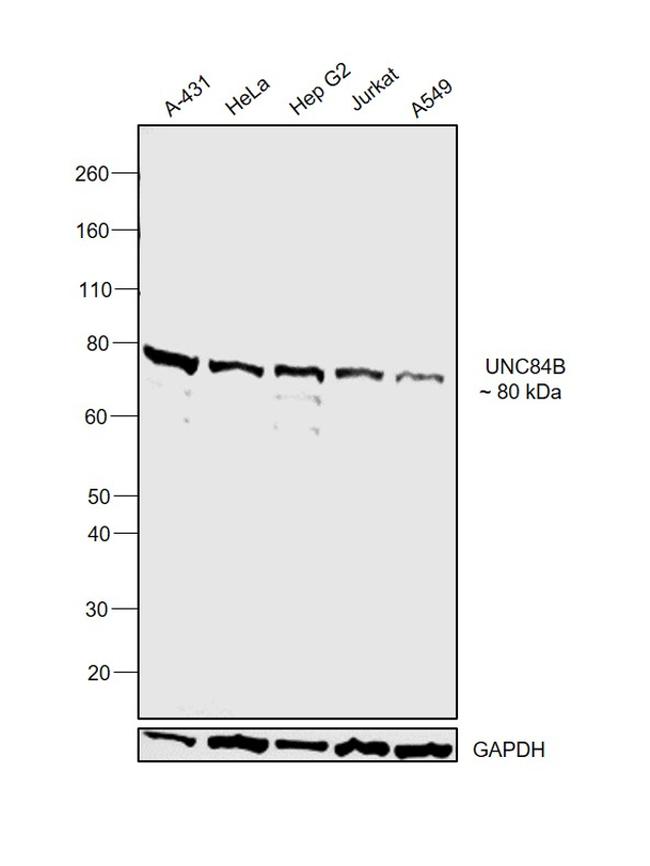 UNC84B Antibody in Western Blot (WB)