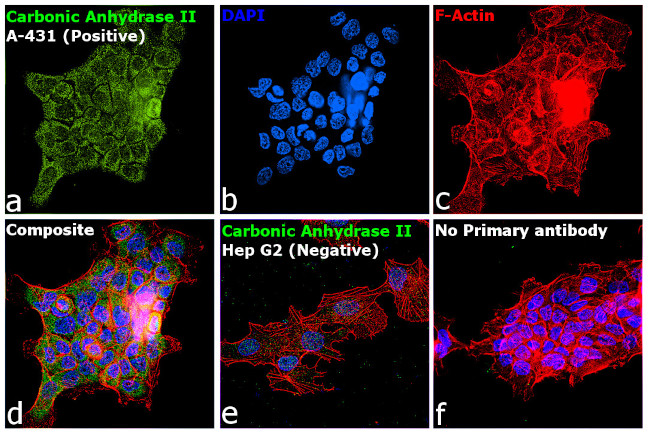 Carbonic Anhydrase II Antibody