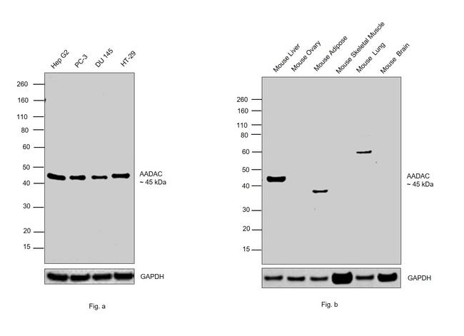 AADAC Antibody in Western Blot (WB)