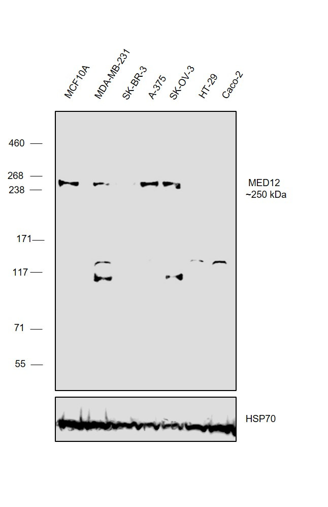 MED12 Antibody