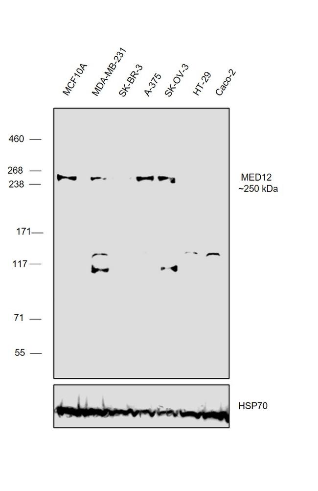 MED12 Antibody in Western Blot (WB)