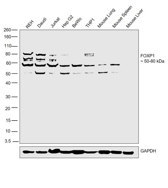 FOXP1 Antibody in Western Blot (WB)