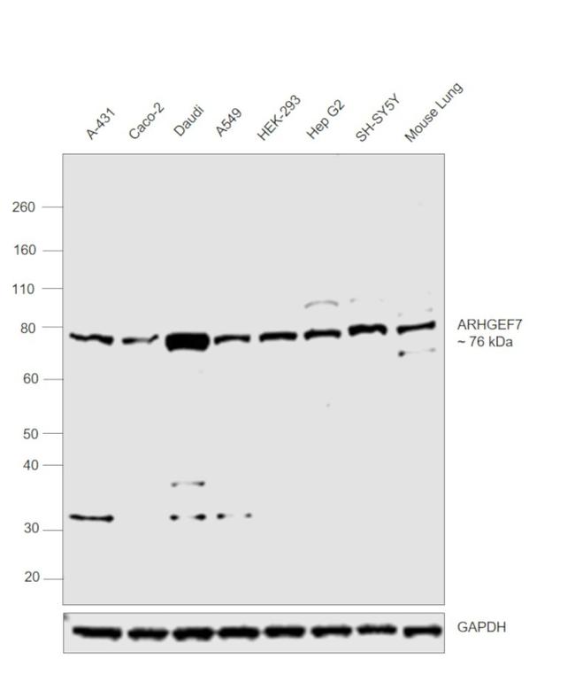 ARHGEF7 Antibody in Western Blot (WB)