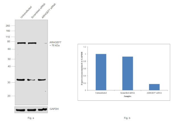 ARHGEF7 Antibody