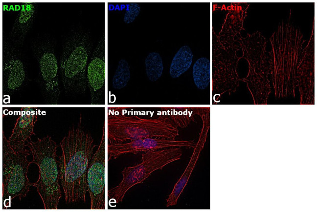 RAD18 Antibody in Immunocytochemistry (ICC/IF)