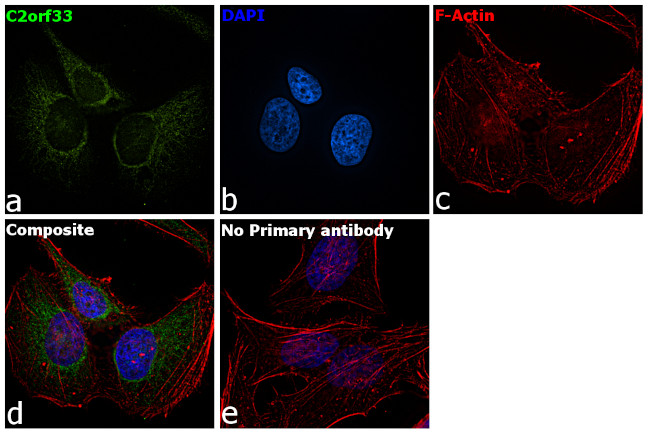 C2orf33 Antibody in Immunocytochemistry (ICC/IF)